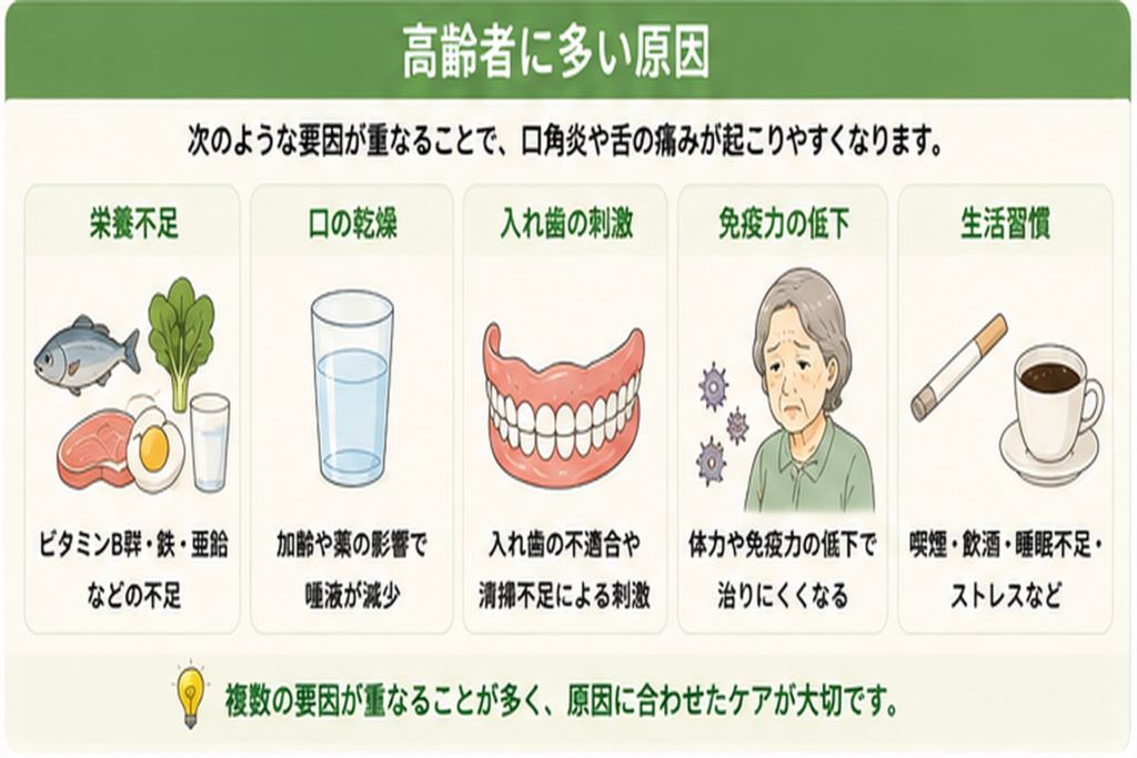高齢者の口角炎や舌の痛みにつながる栄養不足、口の乾燥、入れ歯の刺激などを示した図解